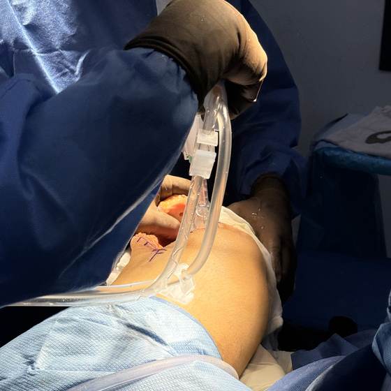 Caso real de artroplastia de rodilla 16