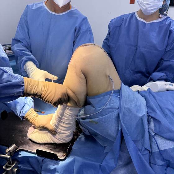 Caso real de artroplastia de rodilla 29
